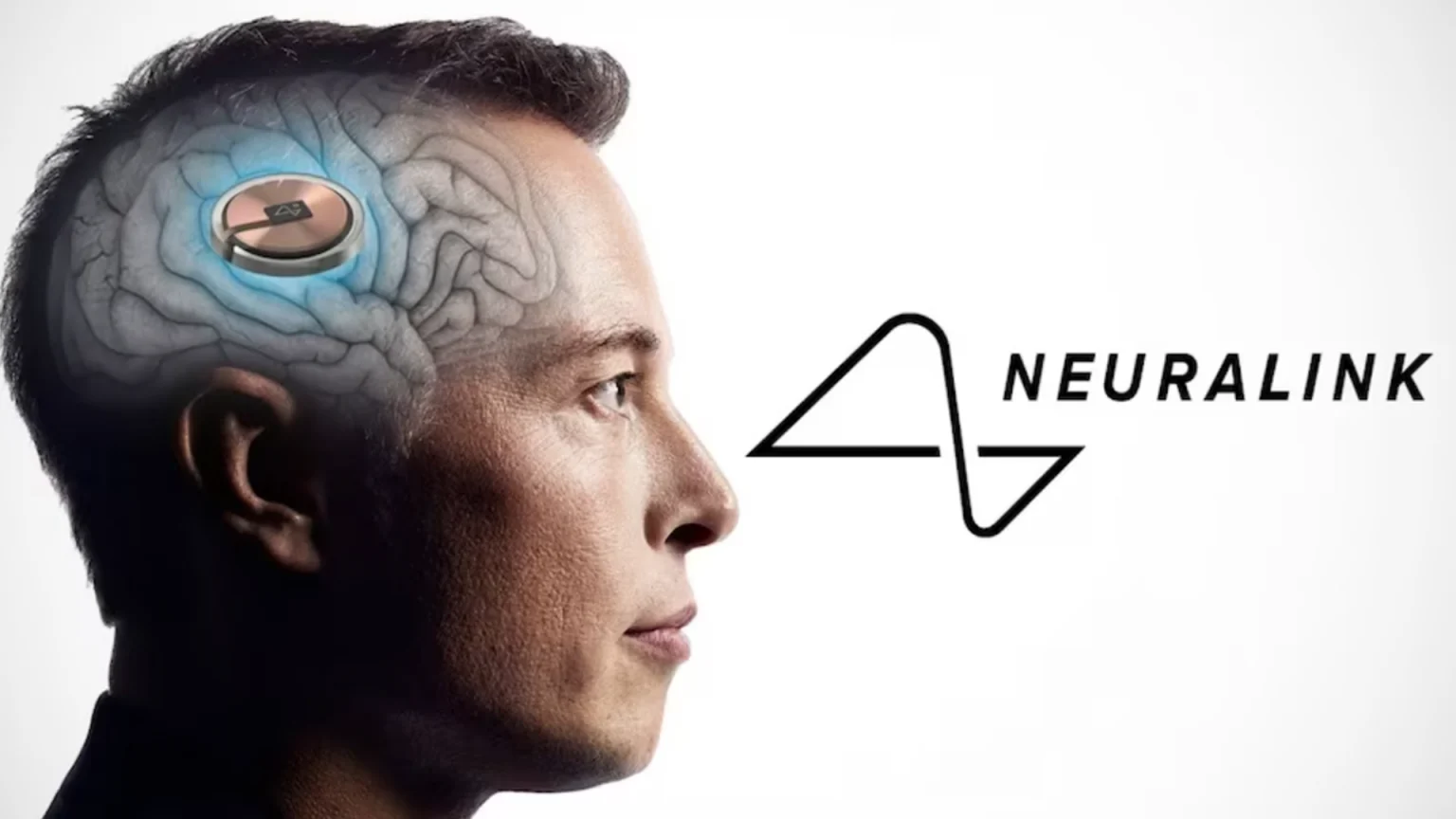 Neuralink, beyin çiplerini Kanada’da klinik olarak test edecek